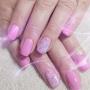 Gel Overlay