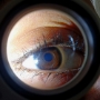 Iridology