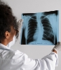 Chest X-Ray