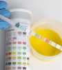Drug and Urine Test