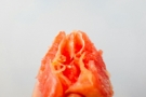 Vaginal Tightening