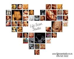 Life scan studio Roodepoort