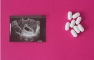 Misoprostol Pills