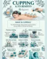 Traditional Chinese Fire Cupping Therapy